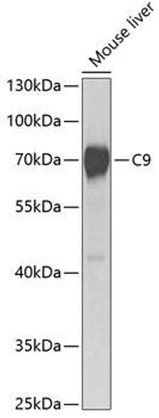 Immunology Antibodies 2 Anti-C9 Antibody CAB5622