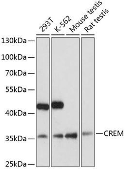 Cell Biology Antibodies 9 Anti-CREM Antibody CAB5624