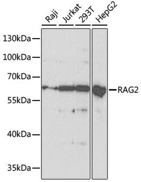 KO Validated Antibodies 1 Anti-RAG2 Antibody CAB5626KO Validated