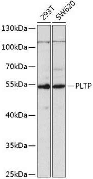 Cell Biology Antibodies 9 Anti-PLTP Antibody CAB5628