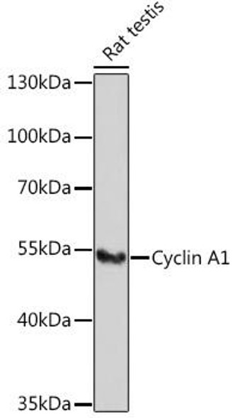 Cell Cycle Antibodies 1 Anti-Cyclin A1 Antibody CAB5631