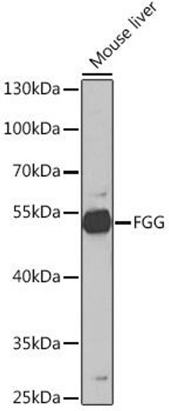 Cardiovascular Antibodies Anti-FGG Antibody CAB5642