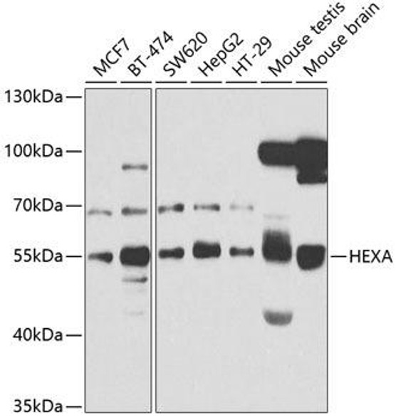 Cell Biology Antibodies 9 Anti-HEXA Antibody CAB5646
