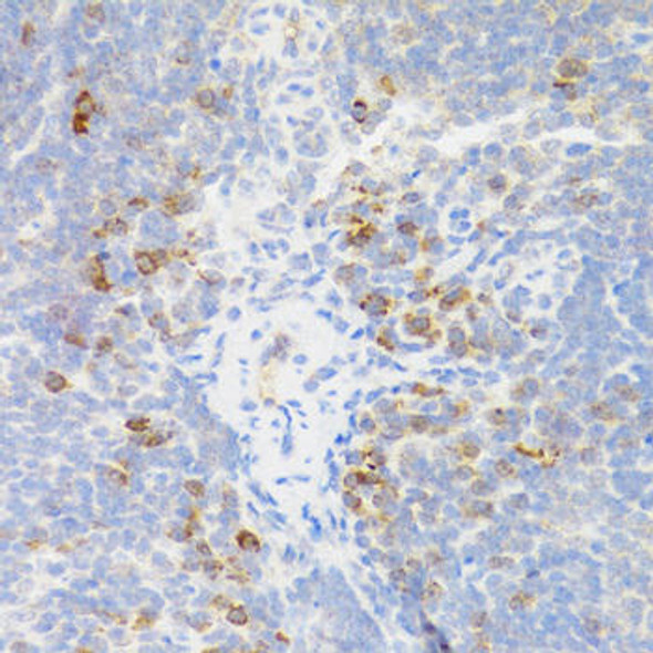 Immunology Antibodies 2 Anti-TNFRSF13B Antibody CAB5658