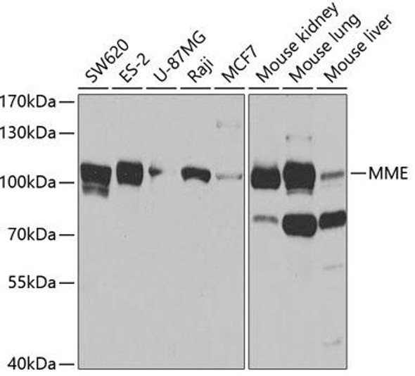 Cell Biology Antibodies 9 Anti-MME Antibody CAB5664