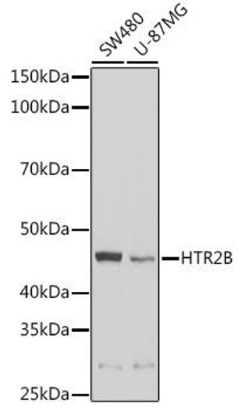 Developmental Biology Anti-HTR2B Antibody CAB5670