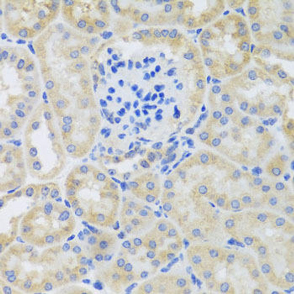 Cell Death Antibodies 2 Anti-BNIP3 Antibody CAB5683