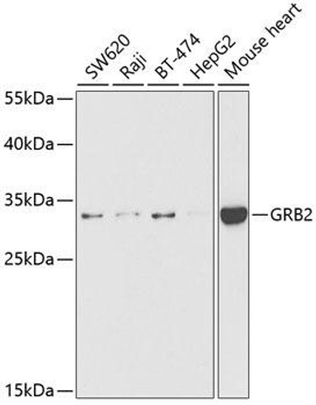 Immunology Antibodies 2 Anti-GRB2 Antibody CAB5689
