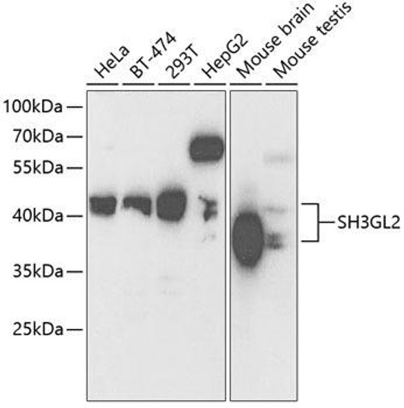 Cell Biology Antibodies 9 Anti-SH3GL2 Antibody CAB5701