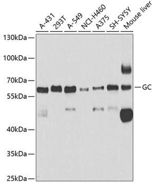 Signal Transduction Antibodies 3 Anti-GC Antibody CAB5709