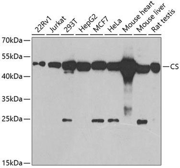 Metabolism Antibodies 2 Anti-CS Antibody CAB5713