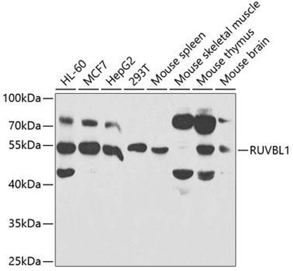 Cell Cycle Antibodies 1 Anti-RUVBL1 Antibody CAB5723