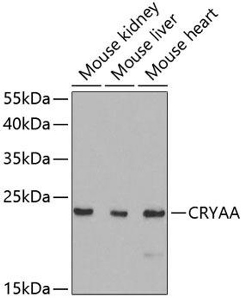 Signal Transduction Antibodies 3 Anti-CRYAA Antibody CAB5725