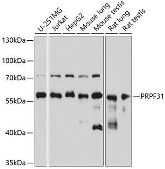 Epigenetics and Nuclear Signaling Antibodies 2 Anti-PRPF31 Antibody CAB5732