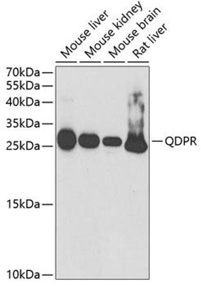 Metabolism Antibodies 2 Anti-QDPR Antibody CAB5733