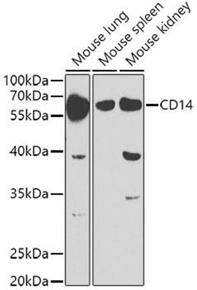 Immunology Antibodies 2 Anti-CD14 Antibody CAB5737