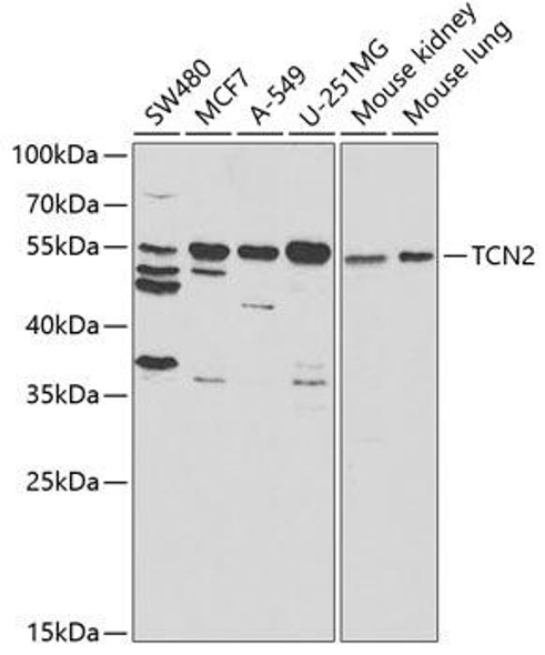 Signal Transduction Antibodies 3 Anti-TCN2 Antibody CAB5755