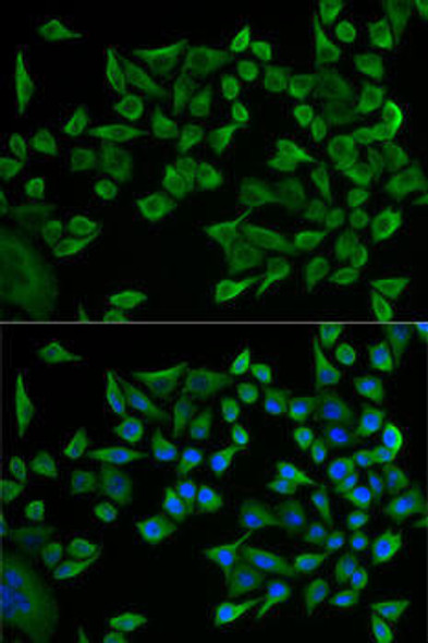 Cardiovascular Antibodies Anti-WARS Antibody CAB5758