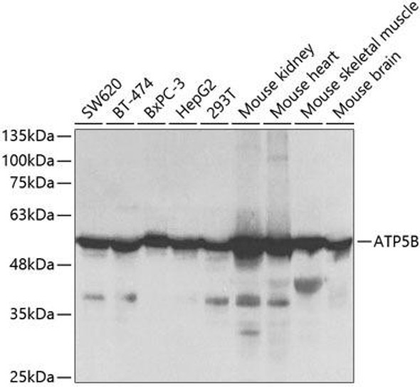 Metabolism Antibodies 2 Anti-ATP5B Antibody CAB5769