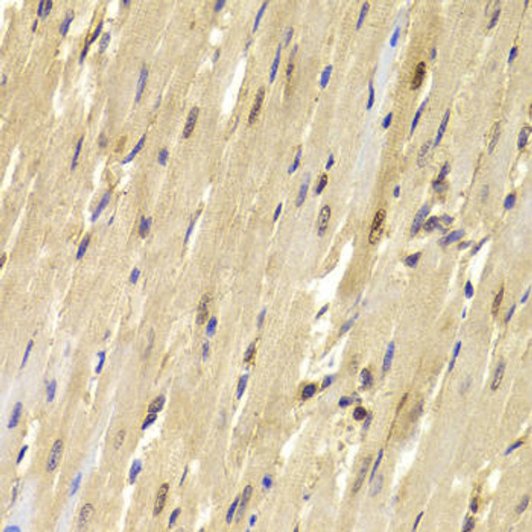 Epigenetics and Nuclear Signaling Antibodies 2 Anti-TOPBP1 Antibody CAB5781