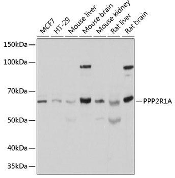 Epigenetics and Nuclear Signaling Antibodies 2 Anti-PPP2R1A Antibody CAB5799