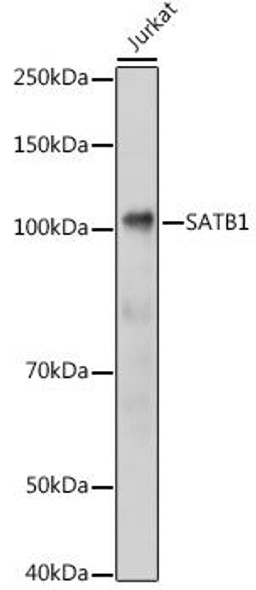 Immunology Antibodies 2 Anti-SATB1 Antibody CAB5800