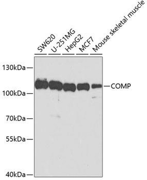 Cell Death Antibodies 2 Anti-COMP Antibody CAB5812