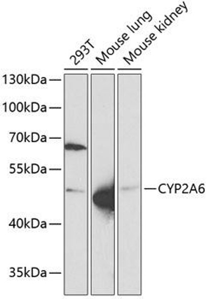 Cell Biology Antibodies 9 Anti-CYP2A6 Antibody CAB5815