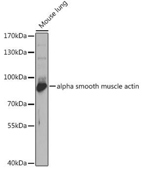 Epigenetics and Nuclear Signaling Antibodies 2 Anti-EZH1 Antibody CAB5818