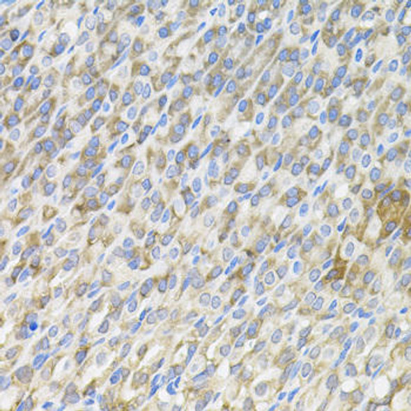 Immunology Antibodies 2 Anti-MBL2 Antibody CAB5825