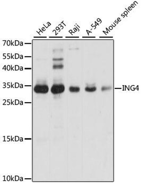 Cell Death Antibodies 2 Anti-ING4 Antibody CAB5833
