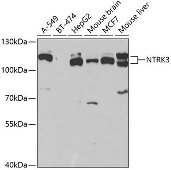 Developmental Biology Anti-NTRK3 Antibody CAB5842