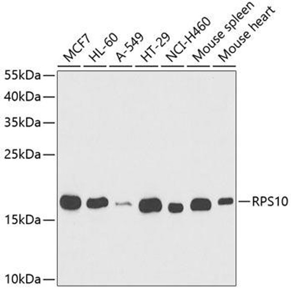 Cell Biology Antibodies 9 Anti-RPS10 Antibody CAB5880