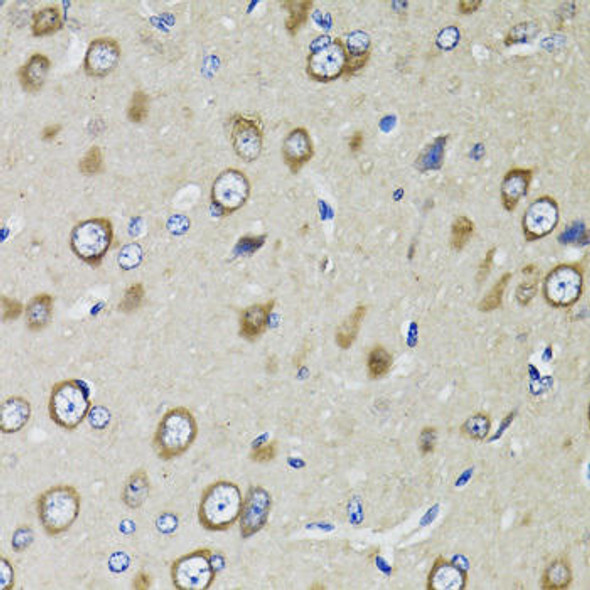 Cell Biology Antibodies 9 Anti-RPS10 Antibody CAB5880