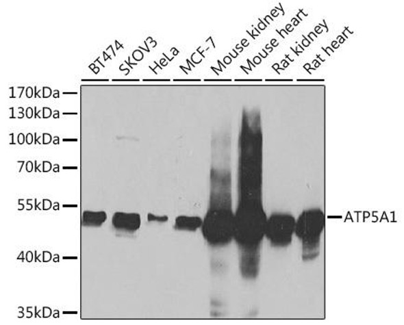 Metabolism Antibodies 2 Anti-ATP5A1 Antibody CAB5884