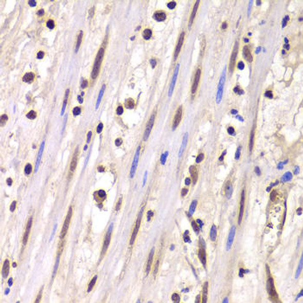 Epigenetics and Nuclear Signaling Antibodies 2 Anti-LSM4 Antibody CAB5891