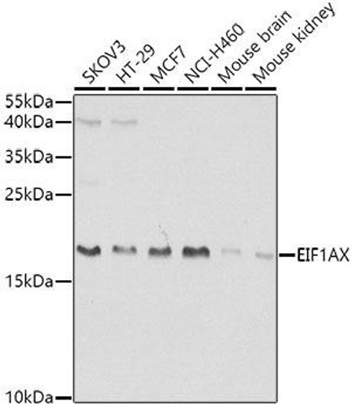 Metabolism Antibodies 2 Anti-EIF1AX Antibody CAB5917