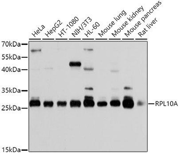 Cell Biology Antibodies 9 Anti-RPL10A Antibody CAB5925