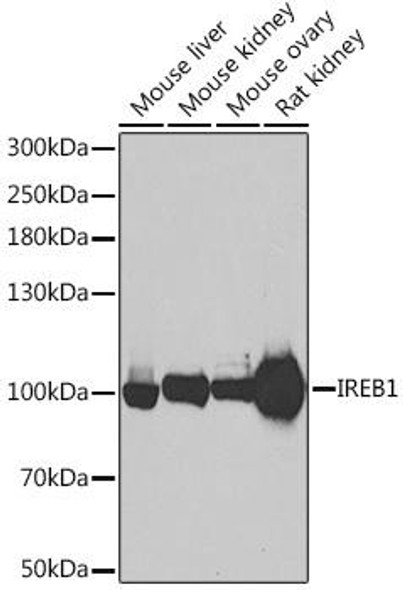 Metabolism Antibodies 2 Anti-IREB1 Antibody CAB6008