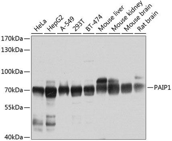 Signal Transduction Antibodies 3 Anti-PAIP1 Antibody CAB6042