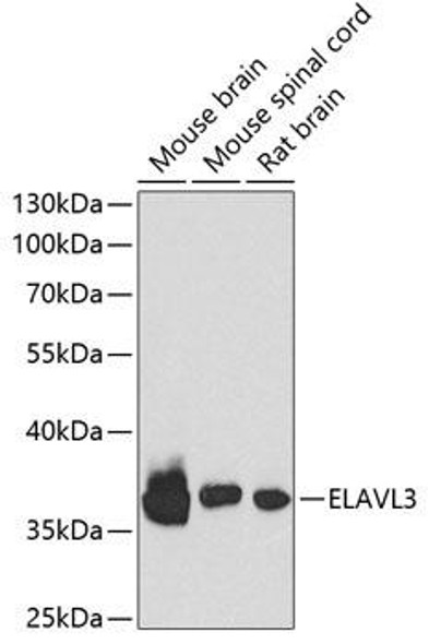 Developmental Biology Anti-ELAVL3 Antibody CAB6091