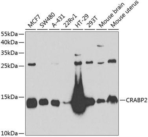 Signal Transduction Antibodies 3 Anti-CRABP2 Antibody CAB6119