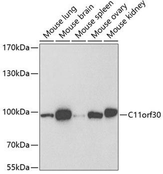 Epigenetics and Nuclear Signaling Antibodies 2 Anti-C11orf30 Antibody CAB6138