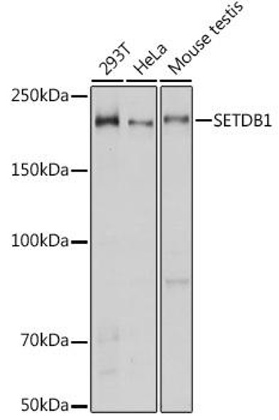 KO Validated Antibodies 1 Anti-SETDB1 Antibody CAB6145KO Validated