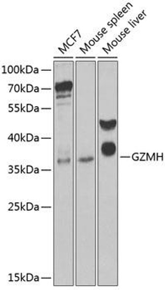 Cell Biology Antibodies 10 Anti-GZMH Antibody CAB6154