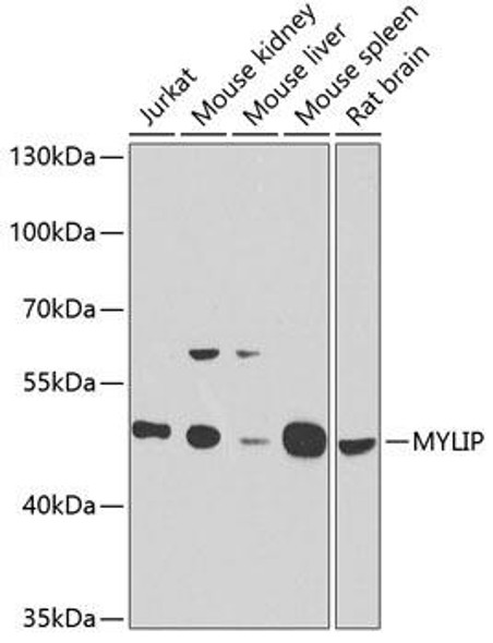 Signal Transduction Antibodies 3 Anti-MYLIP Antibody CAB6166