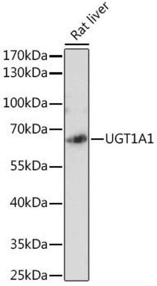 Cell Biology Antibodies 10 Anti-UGT1A1 Antibody CAB6186