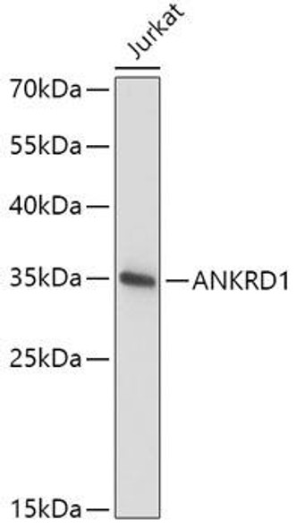 Cell Biology Antibodies 10 Anti-ANKRD1 Antibody CAB6192