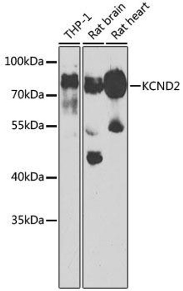 Signal Transduction Antibodies 3 Anti-KCND2 Antibody CAB6203