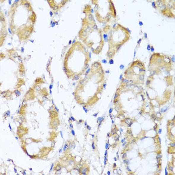 Signal Transduction Antibodies 3 Anti-KCND2 Antibody CAB6203